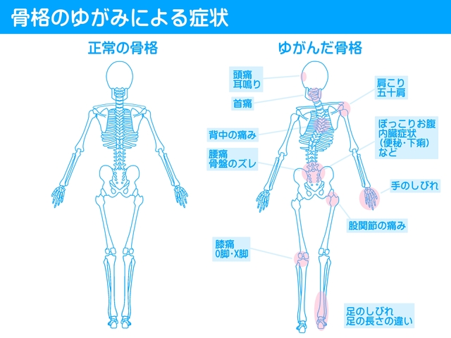 骨格のバランス